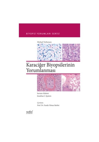 Karaciğer Biyopsilerinin Yorumlanması - Biyopsi Yorumları Serisi