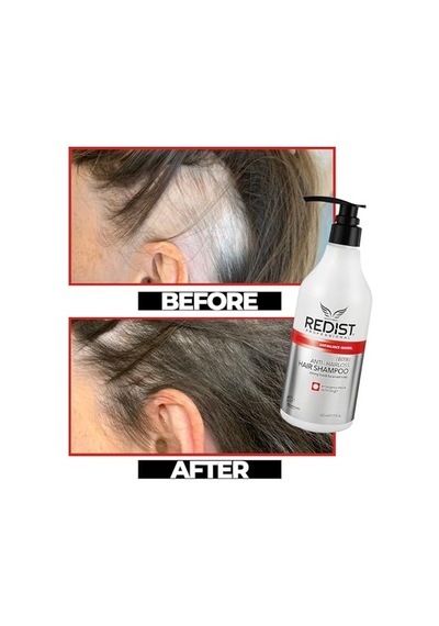 Ayrex Anti Hairloss Saç Bakım Şampuanı 500 Ml 16.90 Fl.oz