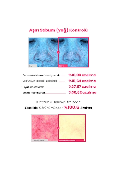 Akneye Eğilimli Ciltler İçin Uygun Kızarık Görünüm Karşıtı Ampul Zeroıd Pimprove Calming Ampoule