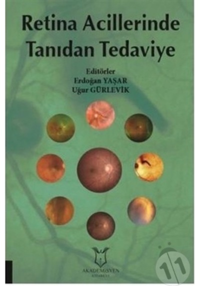 Retina Acillerinde Tanıdan Tedaviye-Erdoğan Yaşar