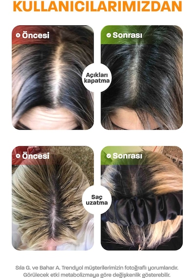 Quality Life Hair Vitamin Complex Saç Vitamini 60 Tablet