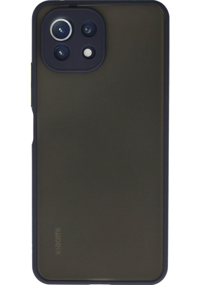 Xiaomi Mi 11 Lite Uyumlu Kılıf Montreal Silikon Kapak - Lacivert