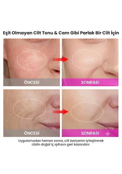 Premium 2 Si 1 Arada Çift Taraflı Rf Ve Ems Yüz Sıkılaştırıcı Ve Kırışıklık Azaltıcı Cihaz Profesyonel Yüz Gençleştirme, Lifting, Anti-aging Cilt Bakım Cihazı Premium 2 Si 1 Arada Çift Taraflı Rf Ve Ems Yüz Sıkılaştırıcı Ve Kırışıklık Azaltıcı Cihaz Profesyonel Yüz Gençleştirme, Lifting, Anti-aging Cilt Bakım Cihazı