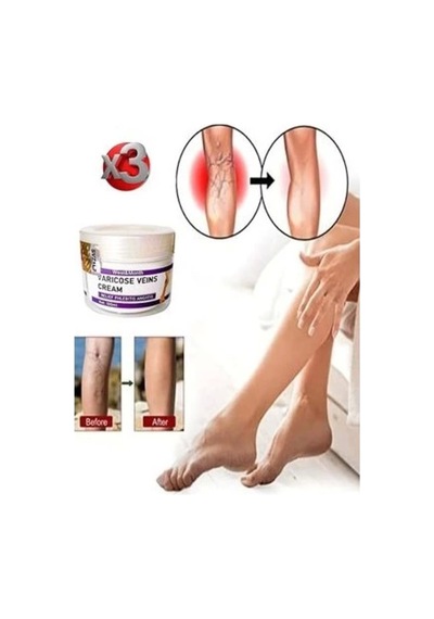 Varicose And Spider Veins Soothing Leg Cream Bacak Bakım Kremi 100 Ml X 3 Adet