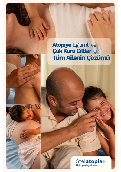 Mustela Stelatopia Cream 150 Ml 2 Adet