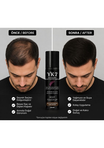 Yk7 Koyu Kahve/dark Brown Saç Dolgunlaştırıcı Ve Dip Kapatıcı Topik Sprey 150 Ml.