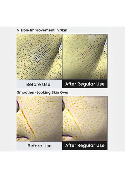 Lexroo The Liva Retinal Shot Tightening Booster Krem, Sıkılaştırıcı Yüz Kremi