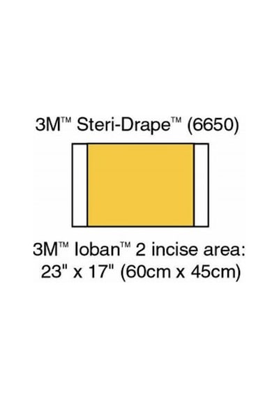 Ioban 2 - Antimikrobiyal İnsizyon Örtüsü - 56 Cm X 45 Cm