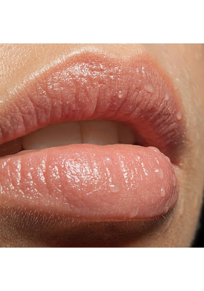 Lip Treat Dudak Balmı 10 Ml 72407532