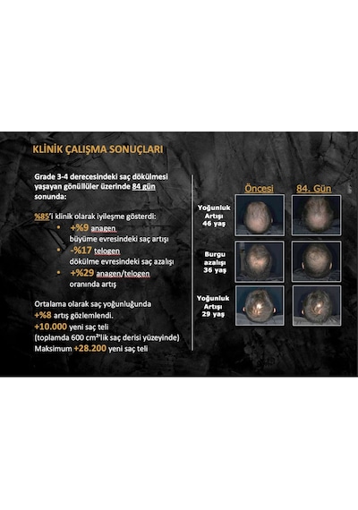 Morgan's Pomade Hair Growth Volume Spray - Dökülme Karşıtı Yenileyici Sprey 120 Ml