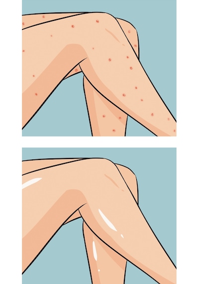 Skin Sensual Buttoks Buttne Vücut Maskesi | Vücut Sivilceleri ve Pürüzlere Karşı | 2 Parça