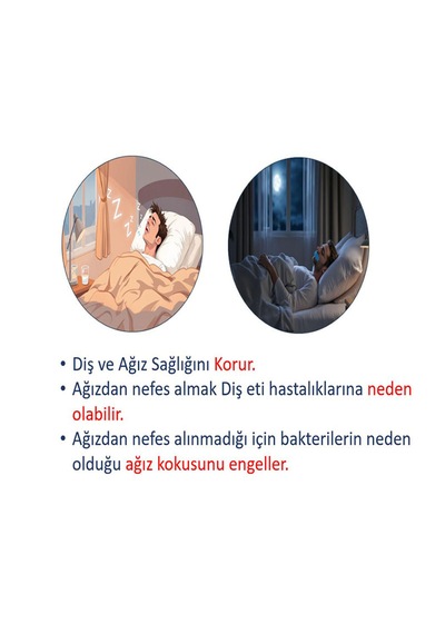 İnobag Ağız Bandı Horlama Önleyici - 30 Adet Siyah Renk Pamuk Kumaş,