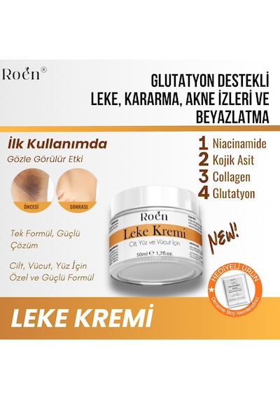 Roen Kararma Ve Akne Lekeleri Glutatyon İçeren Leke Kremi 50 ML