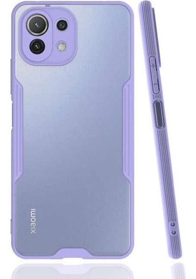 Xiaomi Mi 11 Lite Kilif Kamera Korumali Colorful Kapak 502111114