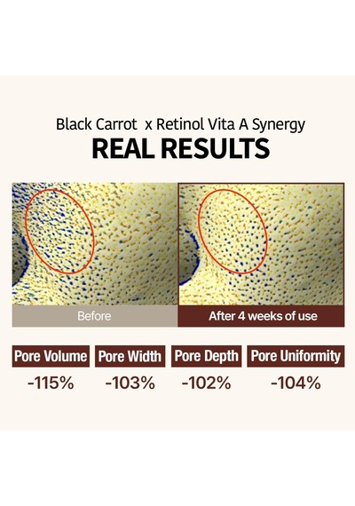 Tr Siyah Havuç Özü Ve Saf Retinol İçeren Ampul Black Carrot Vita-a Retinol Firming Ampoule