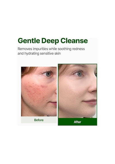 Cica Pdrn Gel Cleanser 200 Ml Hassas Ciltler İçin Nazik Jel Temizleyici Bariyer Destekleyici