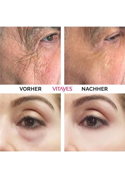 Vitayes Instant Ageback Anında Etkili Yüz Germe Kremi 15 ML
