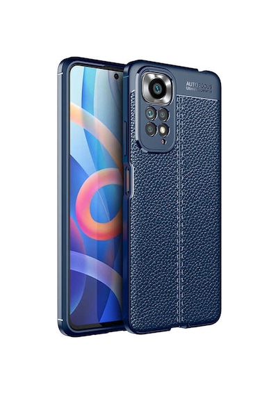 Xiaomi Redmi Note 11 Pro Kilif Lens Deri Görünümlü Niss Silikon