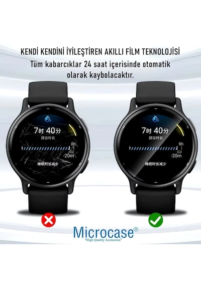 Microcase Apple İos Uyumlu Apple Watch Uyumlu Series 11 İle Tpu Ekran Koruma Filmi - Ekm109