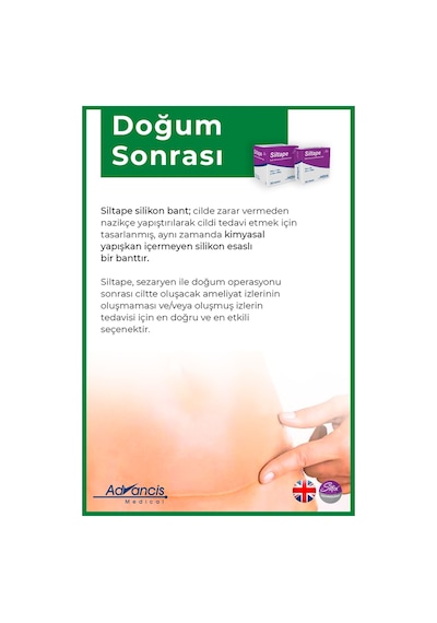 Advancis Medical UK Siltape Soft Silikon Yara İzi Dikiş İzi Sezaryen Yanık Estetik Bant 2 CM x 3 M