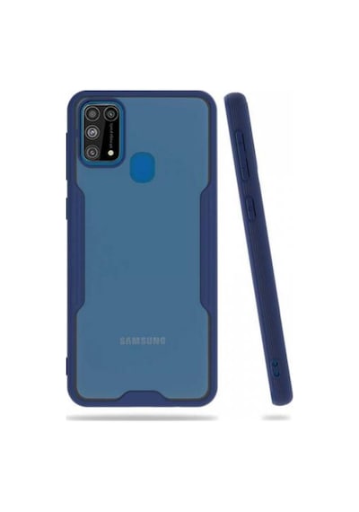 Galaxy M31 Kılıf Zore Parfe Kenarları Pastel Renk Silikon Kılıf