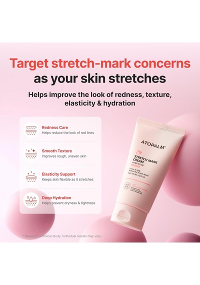 Hamilelere Özel Yoğun Nemlendirici&besleyici Çatlak Kremi Maternity Care Stretch Mark Cream