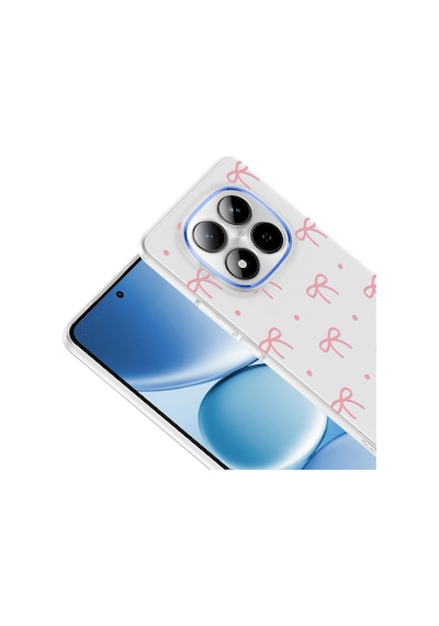Redmi Note 15 Pro 4g Kılıf Kamera Korumalı Desenli Zore Klip Kapak - Fiyonk