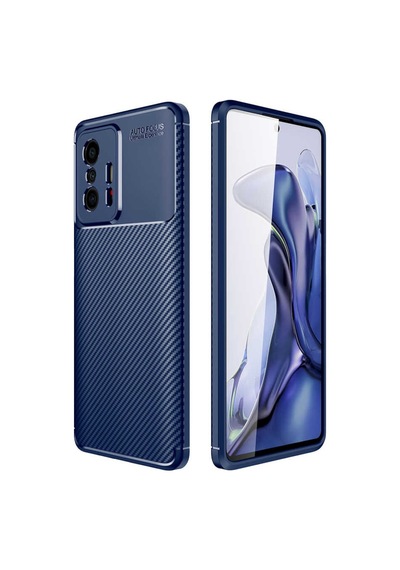 Xiaomi Mi 11T Pro Kilif Lens Karbon Tasarim Negro Silikon Kapak 522480108