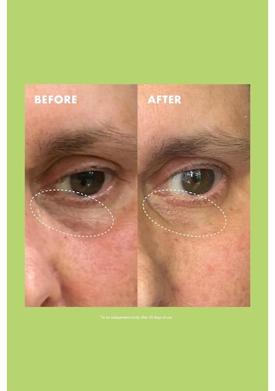 Kopari Niacinamide & Caffeine Aydınlatıcı Göz Kremi 15gr
