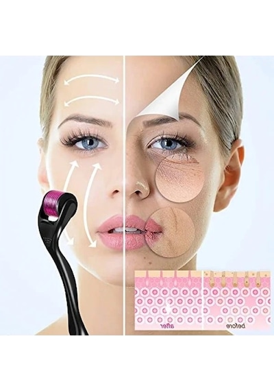 Derma Roller - 1.0mm, 540 Mikro İğne