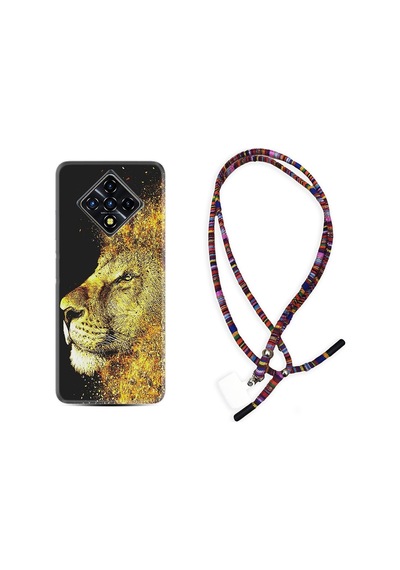 Infinix Zero 8 Kılıf Rasta Boyun Askılı Leon 1323