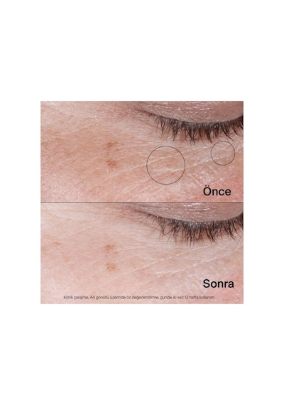 Collagen Bank Dudak Dolgunlaştırıcı Balm 12ml + Collagen Bank Canlandırıcı Jel Göz Kremi 15 G