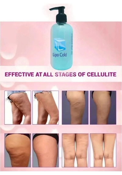 Süper Lipo Cold G.çlü Krem 250 Ml