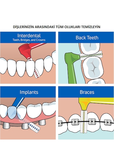 Hannah Saplı Arayüz Fırçası 20+2 Adet 0.8 Mm Sarı Renk Diş Arası Fırçası