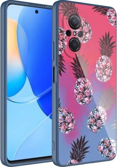 Huawei Nova 9 Se Kılıf Kamera Korumalı Desenli Sert Silikon Zore Epoksi Kapak NO3