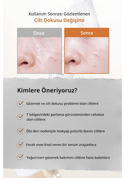 Aha Bha Pha İçeren Sebum Dengesi & Sıkı Gözenek Görünümü Sunan Serum Mıdha Pore Refining Serum