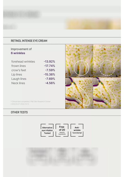 Some By Mi Retinol Intense Cilt Bakım Seti