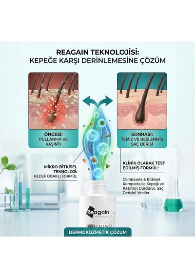 Kepeğe Karşı Etkili Sülfatsız Doğal Saç Bakım Şampuanı - Normal/yağlı Ve Kepekli Saç 250 Ml