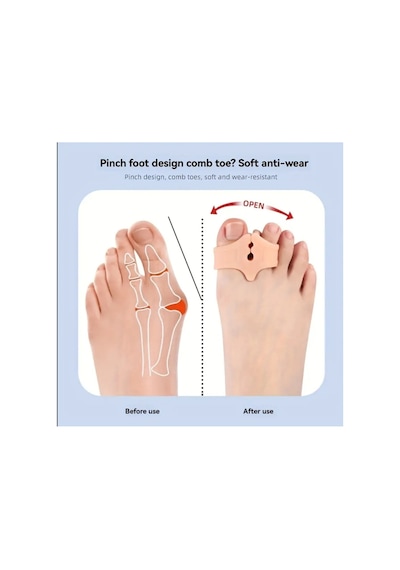 Xınxın Çift Delikli Terlik Sandalet Klipsi, Ayak Parmak Bölmeli Halluks Valgus Çatal Ayırıcı Beyaz Xınxın Çift Delikli Terlik Sandalet Klipsi, Ayak Parmak Bölmeli Halluks Valgus Çatal Ayırıcı Beyaz