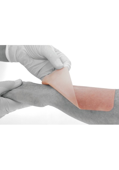 Advasil Conform 10Cm x 15Cm Silikon Jel Tabaka Skar – Keloid