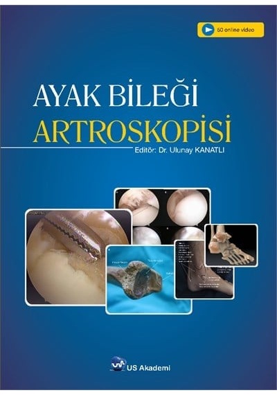 Ayak Bileği Artroskopisi