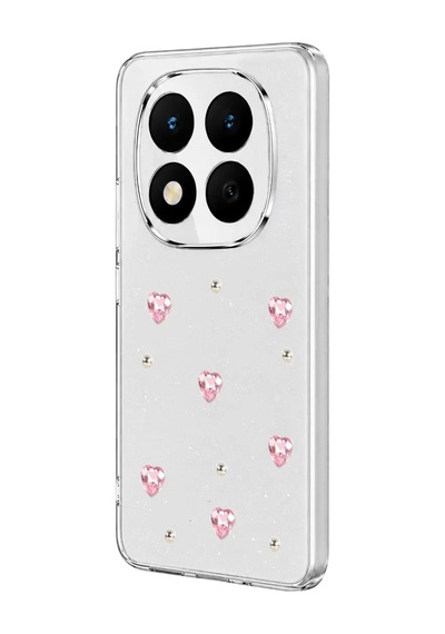 Note 15 4g Fiyonk Desenli Kapak - Desen 3