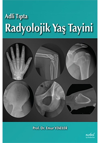 Adli Tıpta Radyolojik Yaş Tayini- Nobel Tıp Kitabevleri