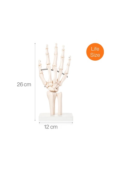 El Eklemi Modeli