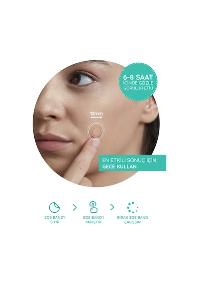S.o.s Mixy 24 Lü Yüz Için Sivilce/akne Bandı 4 Boy Pimple Patch-hidrokolloid Bant