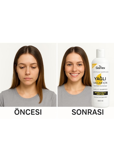 Sanjana Saç Bakım Seti 6'lı
