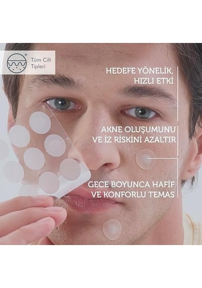 The Purest Solutions Microneedle Akne Bandı 9&apos Lu