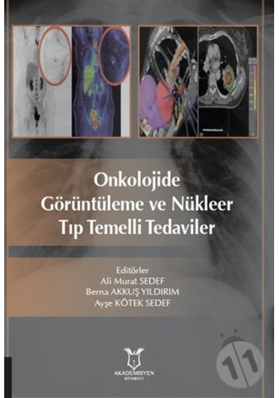 Onkolojide Görüntüleme Ve Nükleer Tıp Temelli Tedaviler-Ali Murat