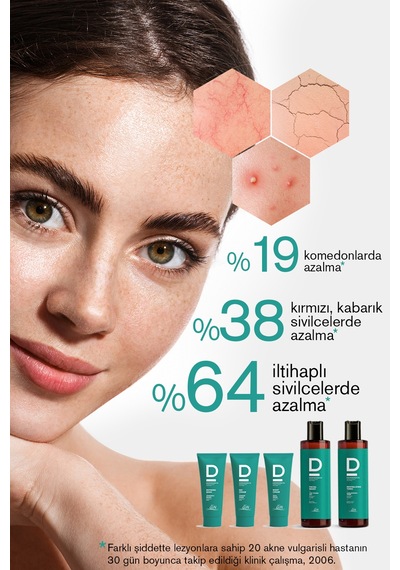 Siyah Nokta,sivilce Ve Akne Karşıtı Onarıcı Ve Nemlendirici Gündüz Kremi 30ml