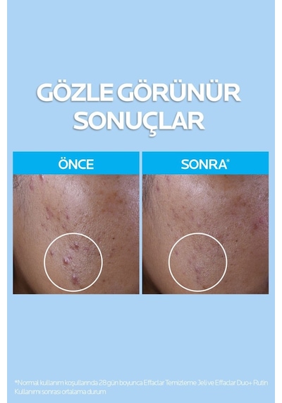 La Roche Posay Güneş Korumalı Cilt Bakım Seti : Effaclar Yüz Temizleme Jeli 400ml & Anthelios Yüz Güneş Kremi 15ml
